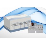TaqMan Real-time PCR Technology RT PCR Test Kits