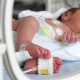 Hemolytic Jaundice in Newborns